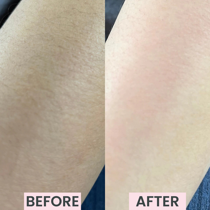 Silkly - Kristall Hårborttagare