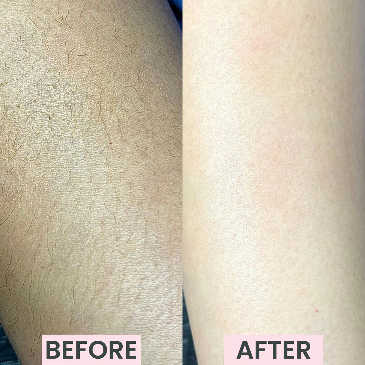 Silkly - Kristall Hårborttagare